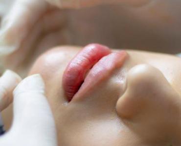 Lifting bez skalpela? Poznaj moc radiofrekwencji mikroigłowej Morfeusz8 i obudź swoją skórę na nowo